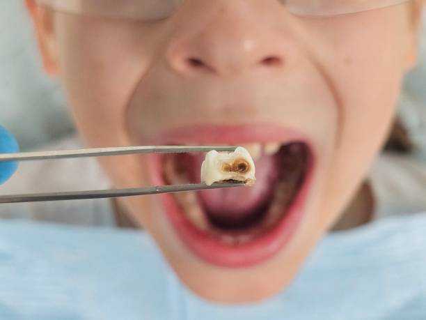 Best Cracked Tooth Emergency Dentist  in Monette, AR