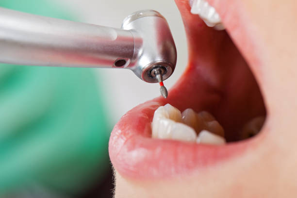 Best Tooth Infection Emergency Dentist  in Monette, AR